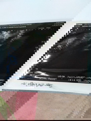 Kantung ada janin tiada