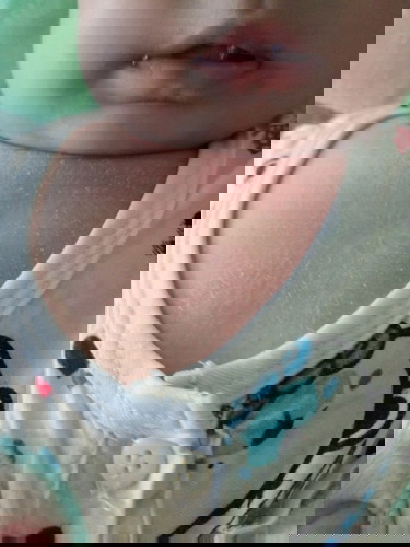 Các mom cho em hỏi bé em được 3 tháng 22 ngày mà bị như vầy là sao ạ sử dụng gì để giảm tình trạng
