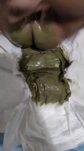 Poop color