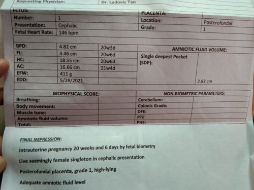 Di marinig masyado ang tibok ng heart ni baby