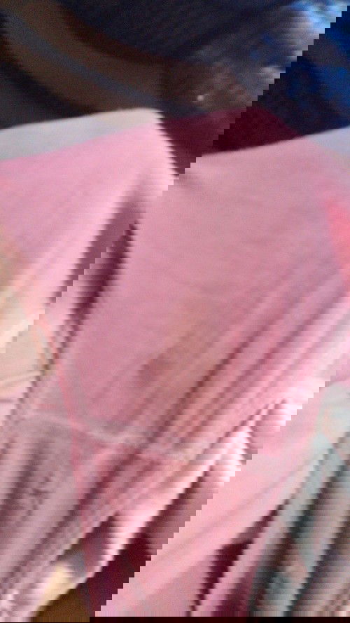 FLEK ATAU KEPUTIHAN ?