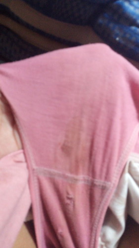 FLEK ATAU KEPUTIHAN ?