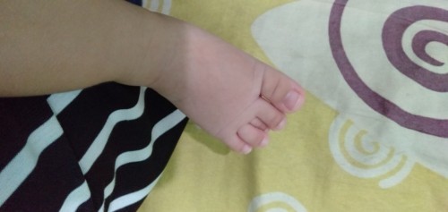 Jari kaki kanan tumpang tindih