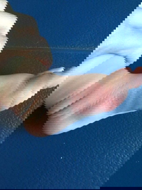 Red patch under sole