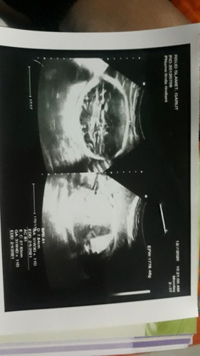 Berbagi Pengalaman Trimester Kedua #DearParentsTAP