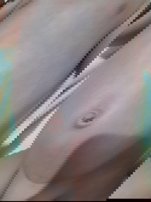 Benjolan pada pusar bayi 1 bulan