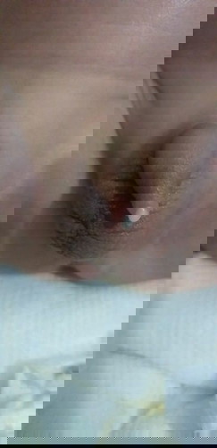 Pa help mga ka asianparent ask ko lang kung meron sainyo ngkaroon ng ganto case ktulad sa baby ko.