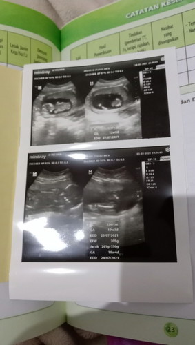 Bun aku hamil anak pertama usia kandung 19w4d tapi BB bayi 3ons
Apakah itu normal?