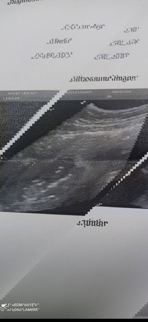 ปรึกษา แม่ท่านไหนเคยเลือดออกบ้างคะไปหาหมอมาให้ยากันแท้งมากิน แต่เลือดยังไม่หยุดนานไหมคะกว่าเลือดหยุด