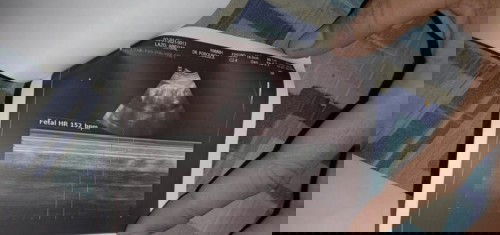 SURE NA KAYANG BABY GIRL???