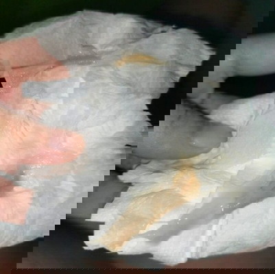 36weeks delivery and preterm labor