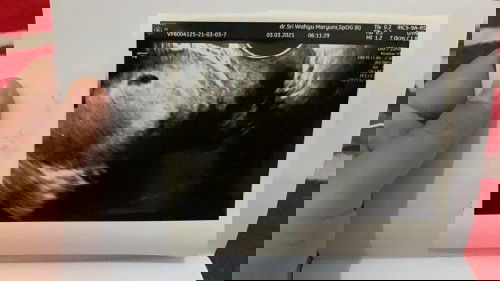 bun. apakah ini sudah ada janinnya ? saya hari pertama haid terakhir tanggal 29 januari 2021.