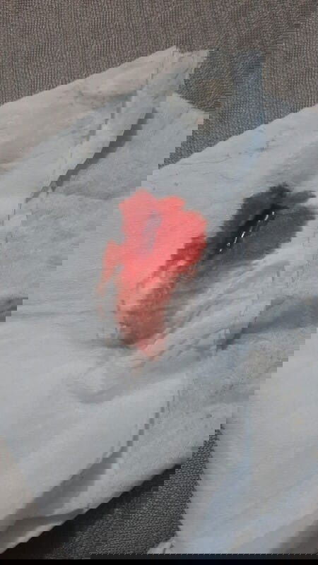 Pendarahan di usai 5 minggu