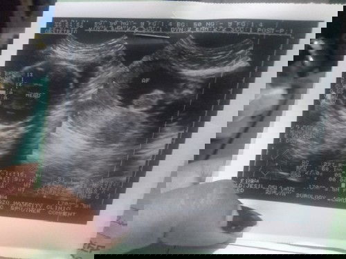 What position my baby