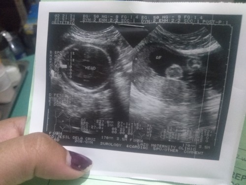 What position my baby