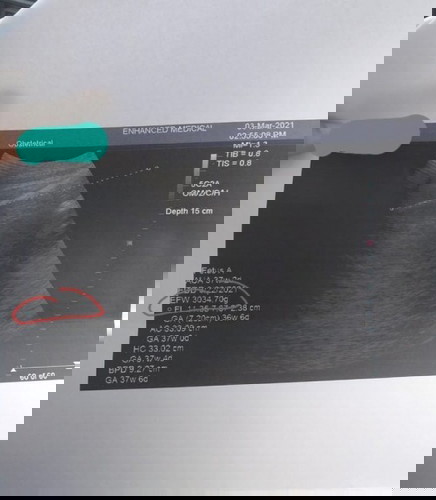 Ultz Result ( EFW )