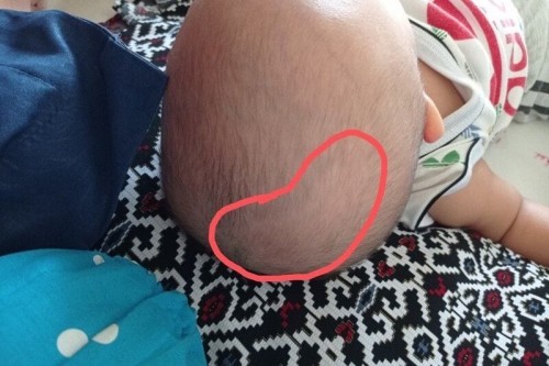 Rambut bayi ga tumbuh2 sebagian