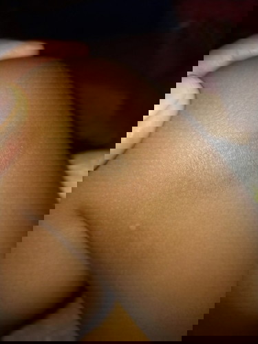 Hy bunda semuanya, sy mau tanya nih anak sy kulitnya dri lahir kering bnget, selalu muncul sprti ini
