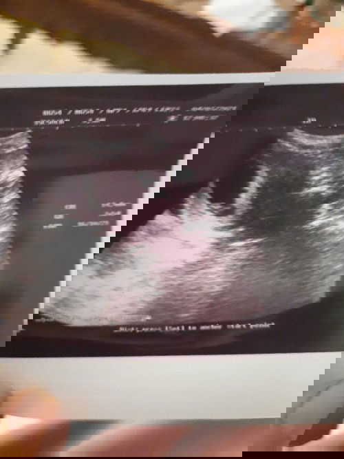 Menurut hpht sudah 11w pas usg 7w5s