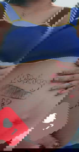 apakah bisa posisi posterior melahirkan normal ?