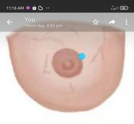 Ada tak timbul biji keras dalam susu ?