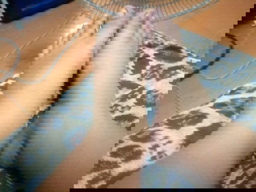 คุณแม่ท้องได้ 30 W เท้าบวมได้3วันแล้ว ปวดมาก ตึง แดง เท้าจะบวมจนถึงวันคลอดเลยไหมค่ะ