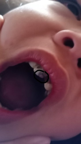 Mouth problem