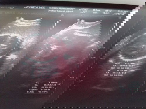 Its a BoY poh 😇❣️

Ano kaya pwedi ipangalan sa kanya nag uumpisa sa Letter AL o AR 
#tnx u😘