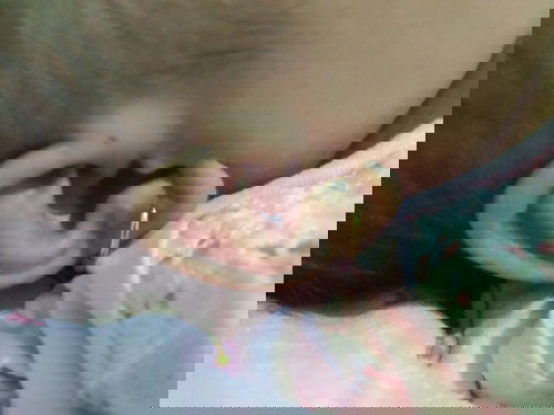 Lubang kecil dekat telinga