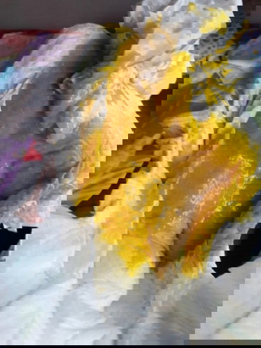 Bayi sering kentut dan tekstur pup