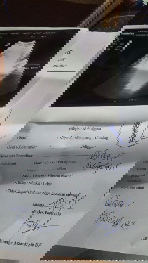 2hari lalu saya keguguran bun.