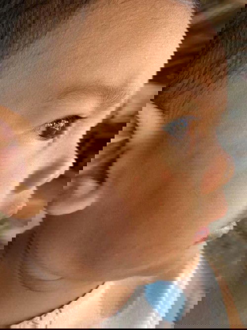 หรือเรียกว่า ส่าไข้ รึป่าวค่ะ