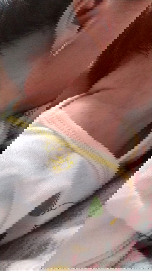 Bintik2 merah di leher bayi