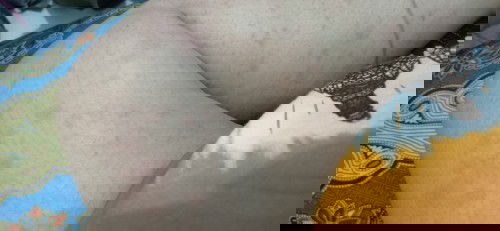 gatal gatal saat hamil 28 week