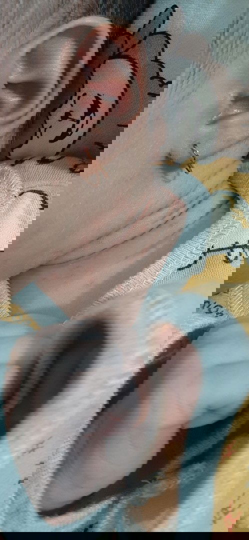 Bintik2 merah di badan