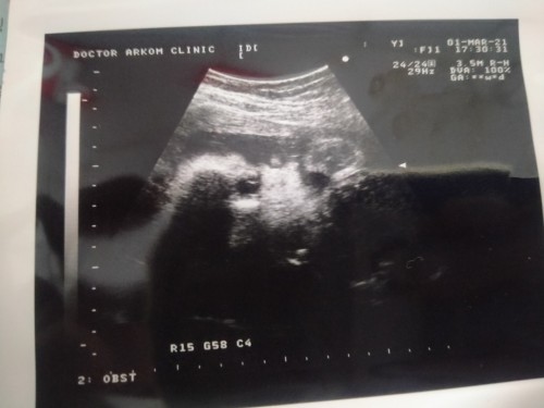 ♥️เด็กทะลึ่งอมมือ(ลูกชาย)