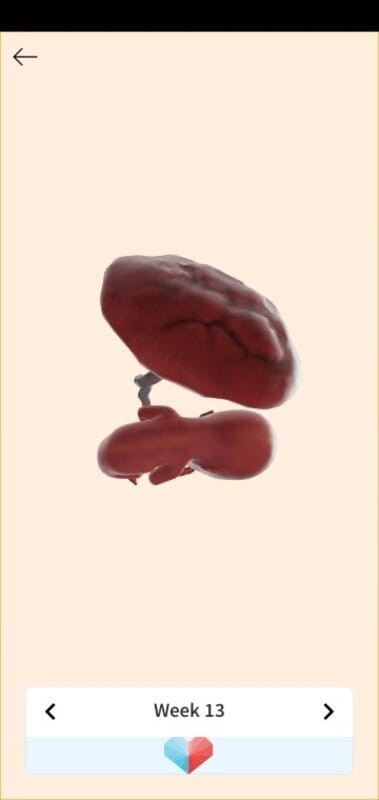 รูปในแอฟกับรูปที่หมออัลตราซาวนด์​  บ้านใหนคล้ายกันบ้าง