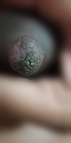 หัวนมแตกเหมือนแผ่นดิน