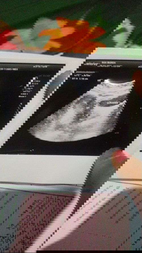 Saya haid udah 30 hari