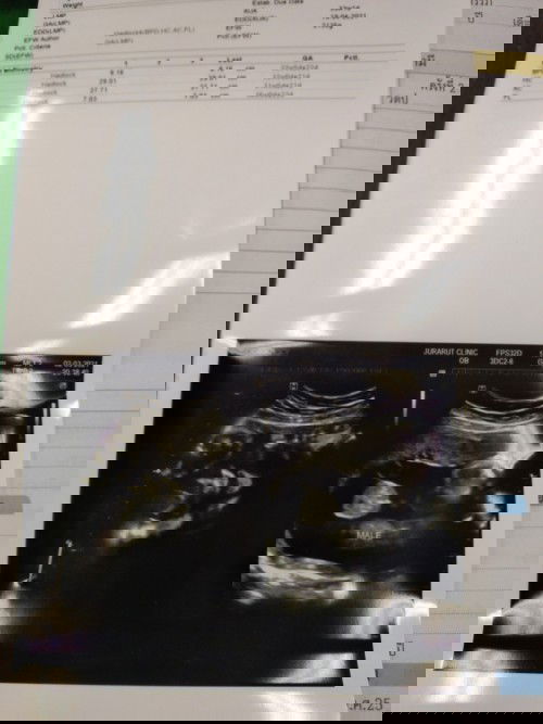 มีใครเคยฝากท้องตอน8เดือน บ้างคะ