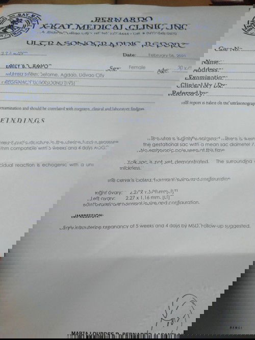 anong ba dapat sundin tvs o midwife counts??