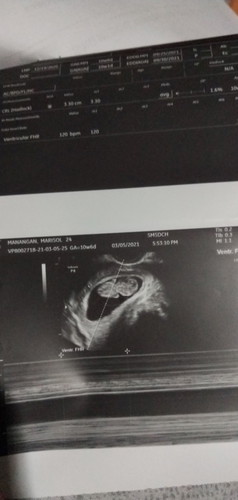 10weeks 1day preggy