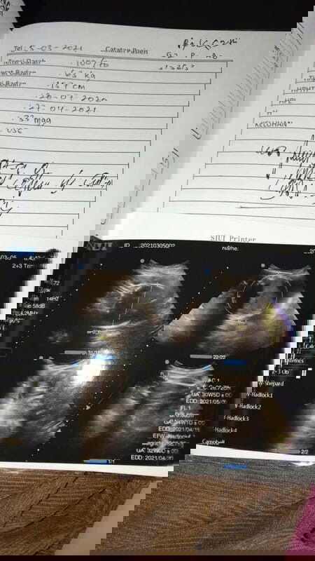 Ini usg berapa dimensi?