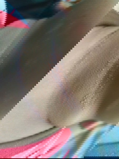 Bintik putih dileher bayi