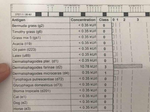 Anak Alergi Debu Tungau atau Dermatophagoides Farinae