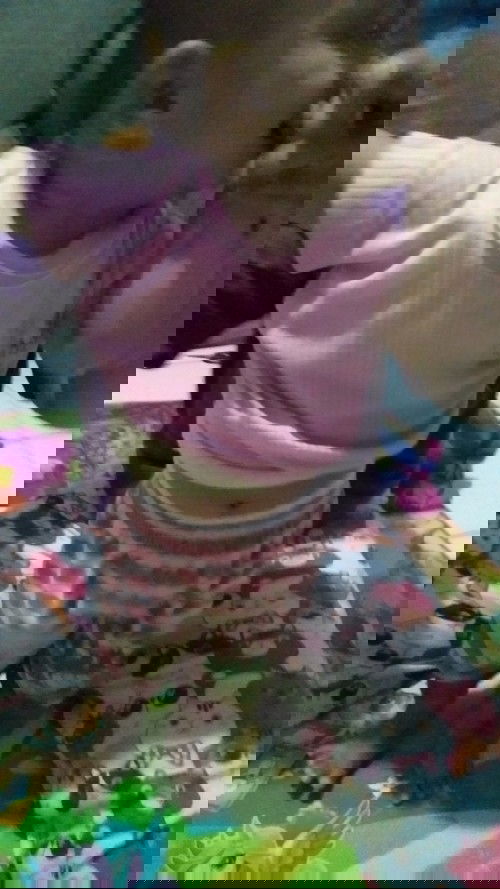 1 tahun 2 bulan belum bisa jalan bun