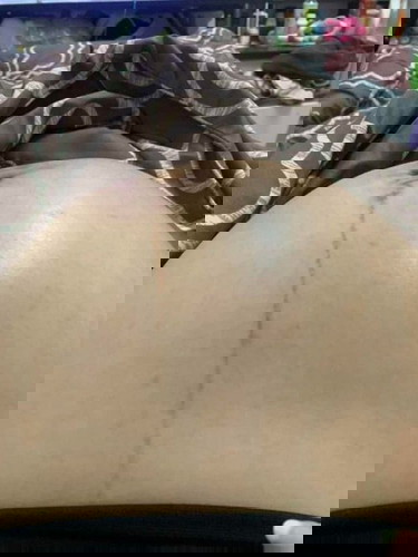 เลือดลมขึ้นหน้า