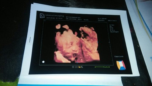 status 4 bulan yang lalu