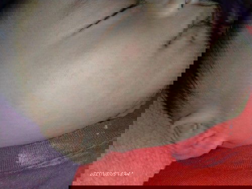 Efek ASI terhadap kulit bayi?