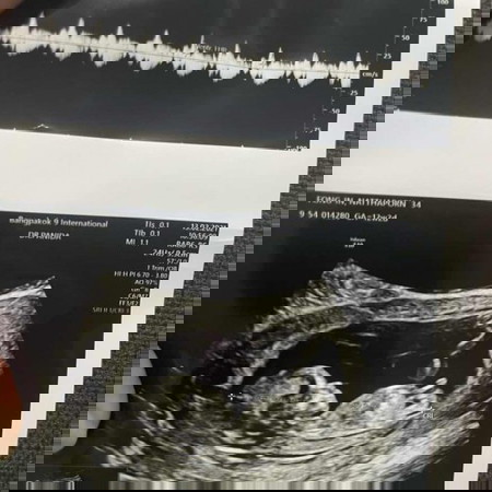 แม่ๆคะผู้หญิงรึผู้ชายคะช่วยดูหน่อยจร้า